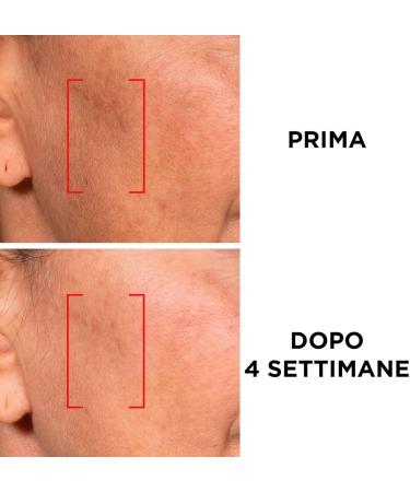 L'Or al Paris Revitalift LOr al Paris Revitalift Laser Triple Action Antiaging day cream SPF 25 with proretinol hyaluronic acid and vitamin C reduces wrinkles hydrates and whitens 2 x 50 ml - Buy Online on GoSupps.com