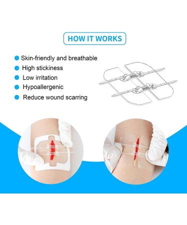 Longmed Zipper Painless Zip Sutures for Laceration Repair - 2.36x2.76 Inch, 2 Pieces/Box - Buy Online on GoSupps.com