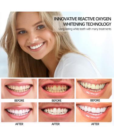 Shop Safe & Effective Tooth Whitening Kits - 28 Non-Sensitive Elevator Strips for Home Use - Buy Online on GoSupps.com