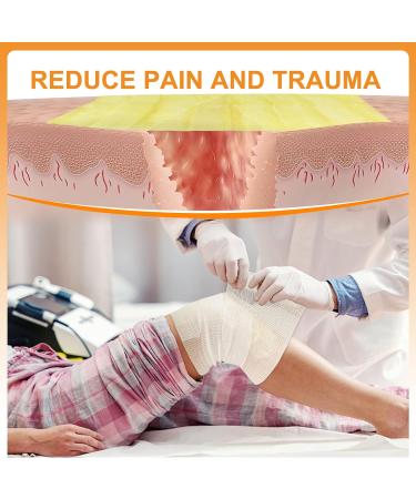 Carbou Medical Xeroform Petrolatum Dressing 5x9 - 25 Pack, Non-Adherent Gauze Pads for Wound Care & Surgical Incisions - Buy Online on GoSupps.com