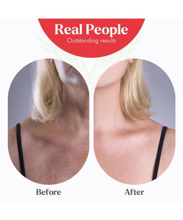 USDA Organic Pomegranate Seed Oil 1 Oz | 100% Pure Natural Moisturizer for Face Skin Hydration & Anti-Aging Hexane-Free Scar Relief Nail Enhancement - Buy Online on GoSupps.com