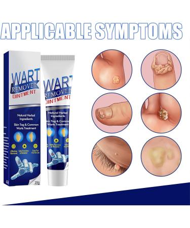 Maximum Strength Wart Removal Cream with Salicylic Acid - Fast-Acting Gel for Genital Plantar Common & Flat Warts - 1PC - Buy Online on GoSupps.com