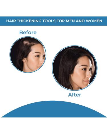 Hair Fiber Applicator for Thin Hair | Atomizer Nozzle for Hair Building Fibers & Thickening | Best Hair Loss Concealer Tool for Men & Women - Buy Online on GoSupps.com