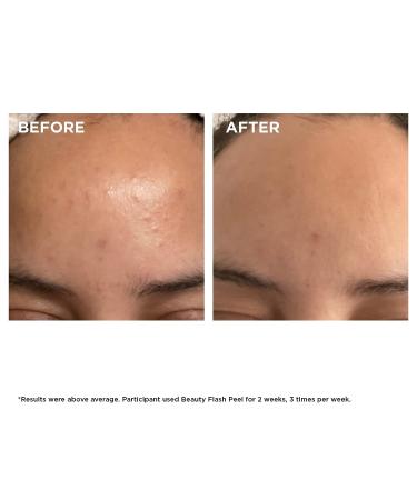 Clarins Beauty Flash Peel: 10-Min At-Home Facial Tightens Pores, Eliminates Dead Skin Cells, Renews Radiance | AHAs & BHAs | For All Skin Types - Buy Online on GoSupps.com