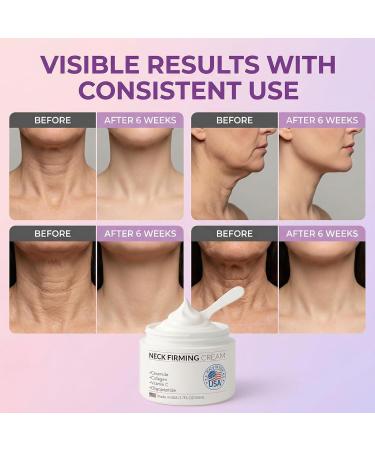 SkiEssance Neck Creams for Tightening and Firming Neck Firming Cream with Collagen Hyaluronic Acid Day & Night Anti-Aging Skin Tighten and Lift Cream for Neck D collet & Face 1.7Fl Oz - Buy Online on GoSupps.com