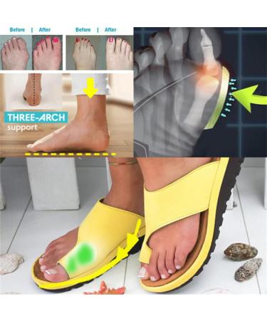 FFMA Women's Big Toe Correction Sandal - Orthopedic Bunion Corrector with Arch Support and Toe Straightening - Yellow, Size 11 - Buy Online on GoSupps.com
