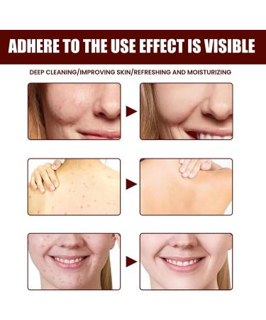 Black Soap - Skin Clean Soap Bar - Face Cleanser Black Soap - Oil Cleansing Washing Moisture Hydrate - Organic Improve Tone Dullness Reduce Dryness Refresh - Enhance Elasticity Shrink Pore Antioxidant - Buy Online on GoSupps.com