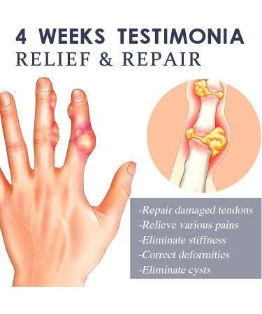 CVREOZ Bienenon Warzen & Tireday Review Treatment Spray - 30ml | Effective Wart Relief & Joint Vitality - Buy Online on GoSupps.com