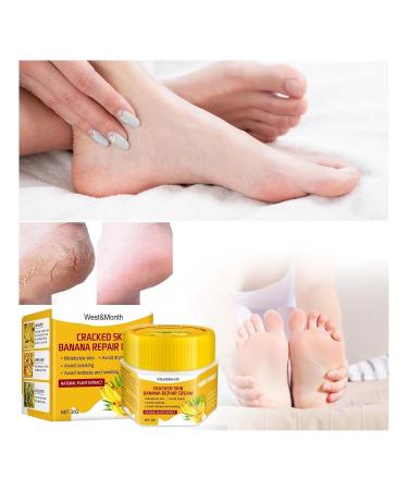Toenail Treatment Cream & Foot Cream for Cracked Heels - Deep Moisturizing & Daily Care (1g Pack) - Buy Online on GoSupps.com