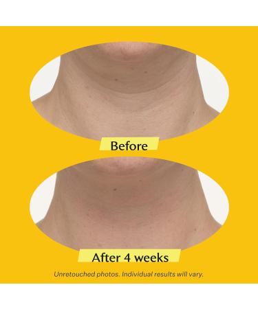 StriVectin TL Advanced Tightening Neck Cream PLUS 0.25 fl oz for Tightening and Firming Neck & D collet Lines Tighten & Lift Advanced Neck Cream Plus .25 fl oz - Buy Online on GoSupps.com