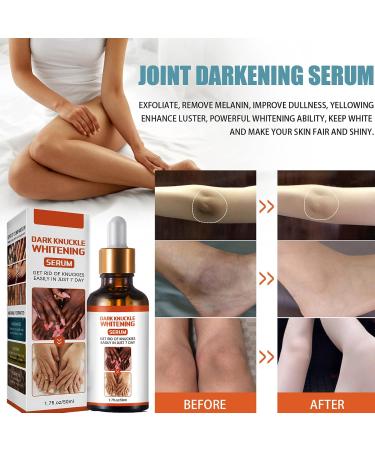 Dark Knuckle Whitening Serum Dark Knuckle Whitening Cream for Dark Knuckle Corrector Lighten Body Black Skin(50g) - Buy Online on GoSupps.com