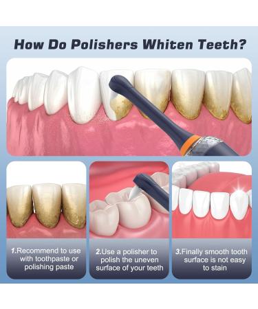 HassoKon Tooth Polisher Kit for Stain Removal & Teeth Whitening - Blue - Buy Online on GoSupps.com