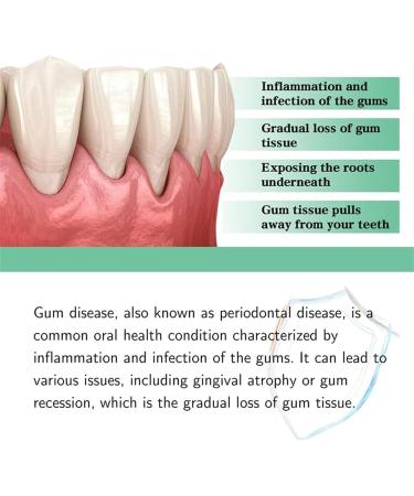 2024 Dentizen Gum Regrowth Drops Dentizen Gum Therapy Gel Dentizen Drops Repair Gum Regrowth for Receding Gum Gum Regrowth Treatment Drops Gum Disease Treatment for Gum Health (3PCS) - Buy Online on GoSupps.com