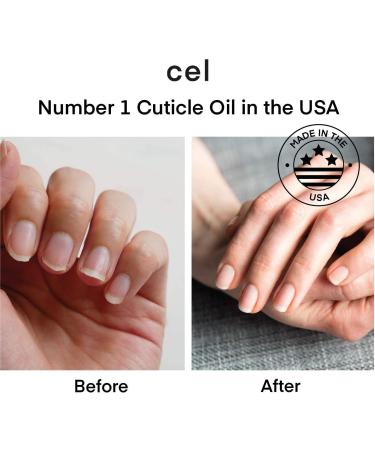 Cel MD Cuticle Oil Pen Set - Nail Repair Serum for Damaged Nails - Strengthens and Nourishes Cuticles - 2 Pack - Buy Online on GoSupps.com
