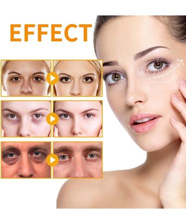 Eye Lifting Gel - Moisturizing Eye Cream | Mild Eye Moisturizer Cream Moisturizing Eye Moisturizing Cream Probiotic Cream for Eyes Portable Eye Care Cream for Women - Buy Online on GoSupps.com