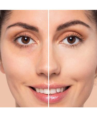 ARTDECO Camouflage Cream 4.5g - Highly Opaque Concealer in Gentle Olive | Best International Shipping - Buy Online on GoSupps.com