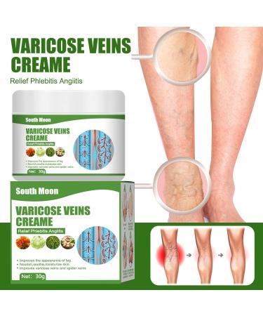  Katutude Repair cream for varicose veins and spider veins. Varicose vein cream to relieve varicose veins and spider veins. - Buy Online on GoSupps.com