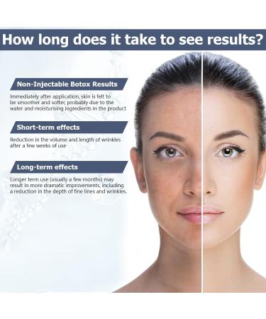 Argireline 10% Serum for Oily Skin - 30ML | Deep Hydration & Youthful Renewal | Anti-Aging Face Serum - Buy Online on GoSupps.com
