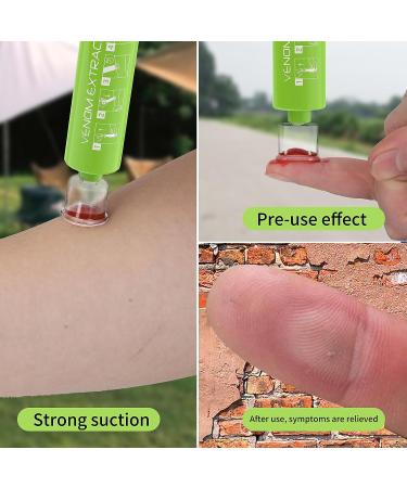 Floverkity Bug Bite Suction Tool - Venom Extractor for Fast Itch Relief | Snake Bite, Mosquito & Bee Sting First Aid Kit - Buy Online on GoSupps.com