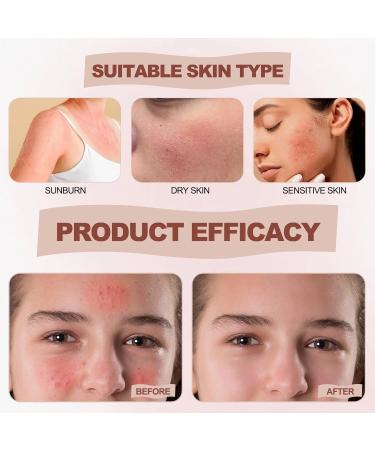 Beef Tallow Cream for Face and Body Skin Care Tallow and Honey Balm Lotion Natural Tallow Moisturizing Cream Beef Tallow Skin Care for Sensitive Skin (118 ml) - Buy Online on GoSupps.com