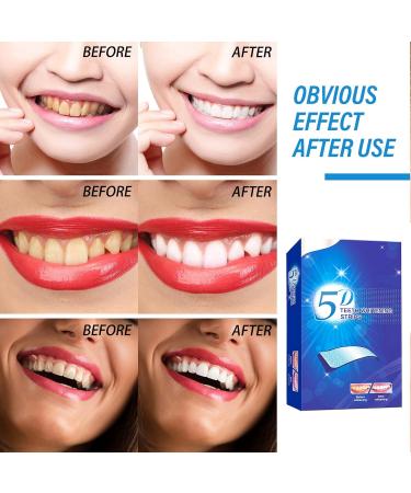  Angivlga 5D Teeth Whitening Strips Sensitive Teeth Whitening Kits Gentle on Enamel and Gums Teeth Whitening Remove White Stripes Coffee Tea Smoking and Wine Stains (28 - Buy Online on GoSupps.com