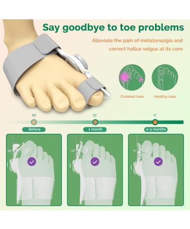 Bunion Corrector for Men & Women | Adjustable Bunion Splint & Toe Separator | Orthopedic Relief for Big Toe Pain (1PC - Buy Online on GoSupps.com