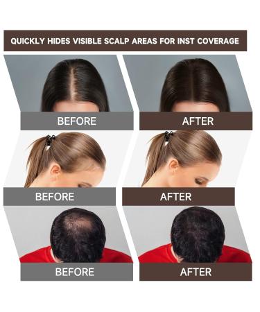 Buy Mifeloy 2-Piece Hairline Powder Set - Dark Brown Concealer & Mirror Sponge for Instant Hair Coverage - Waterproof Hair Makeup for Men & Women - Buy Online on GoSupps.com