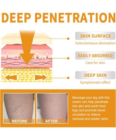2023 New Varicose Veins Miracle Cream - Natural Treatment for Legs (2 Pack) | International Shipping Available - Buy Online on GoSupps.com