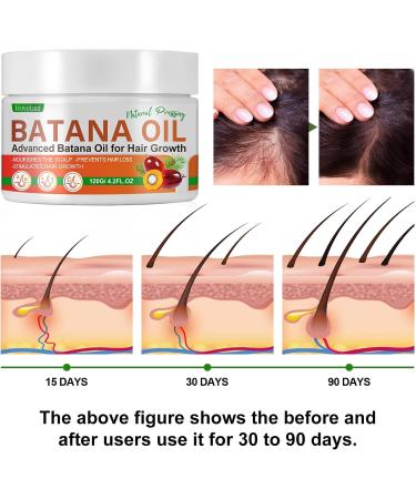 Batana Oil for Hair Growth Hair Growth Oil Organic Prevent Hair Loss Eliminates Split Ends Increases Shine Repairs Damaged Hair & Skin Promotes Hair thickness & Healthiness - Buy Online on GoSupps.com