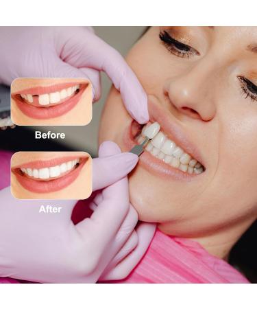 Instant Denture Veneers 1 Pair Removable Teeth Whitening Temporary Denture Upper Lower Teeth Replacement Fake Tooth for Men Women - Buy Online on GoSupps.com