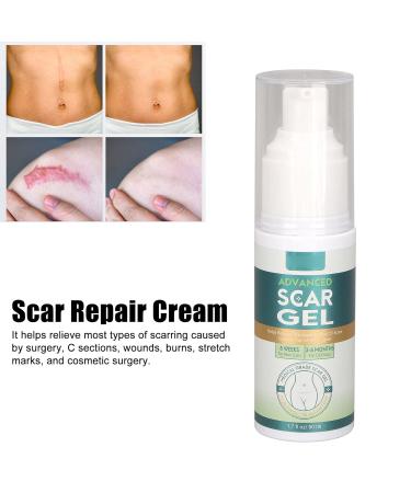 Advanced Scar Repair Cream 50ml - Effective Scar Gel for Prescription Skin Care - Buy Online on GoSupps.com