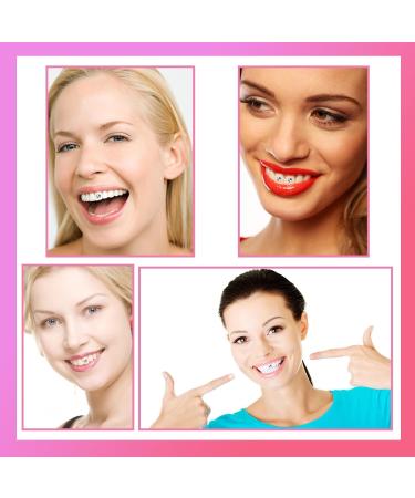 Tooth Gem Kit - DIY Teeth Gems Jewelry for a Shining Smile | Professional Starter Kit for Sparkling Teeth - Buy Online on GoSupps.com