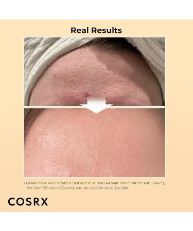 COSRX Snail Mucin Duo - Snail 92 Cream & Snail 96 Essence Daily Face Gel Moisturizer and Hydrating Serum for Face with Snail Secretion Filtrate Korean Skin Care - Buy Online on GoSupps.com