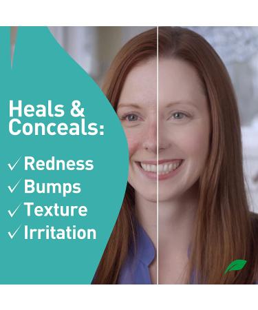 PROcure Rosacare CC Face Cream 2oz - Medicated Redness Reduction & Hyaluronic Hydrogel for Rosacea Symptoms - Buy Online on GoSupps.com