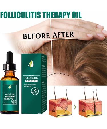 Nmbol Hair Growth Spray 2 - Buy Online on GoSupps.com