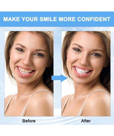 SP-8 Probiotic Toothpaste SP-8 Ultra Whitening Toothpaste Toothpaste with Fresh Breath Deep Cleaning Care Toothpaste for Oral Hygiene (3 PCS) - Buy Online on GoSupps.com