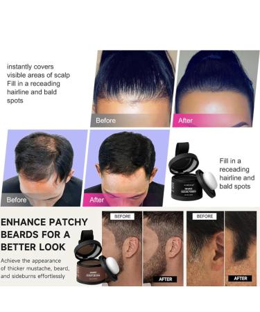 Hairline Shadow Powder | Magic Root Cover Up & Touch Up Powder with Mirror - Instant Concealment for Hair Loss (#06 Dark Brown) - Shop Internationally - Buy Online on GoSupps.com