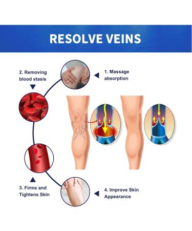 Vein Relief Cream 20g - Natural Varicose Vein Gel for Pain Relief - Buy Online on GoSupps.com