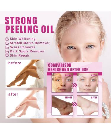 Yellow Peeling Oil Peeling Oil for Dark Skin Strong Peeling Oil Extra Strength Exfoliating Peeling Solution for Body All Skin Type - 110ML/3.66 OZ (2 PCS) - Buy Online on GoSupps.com