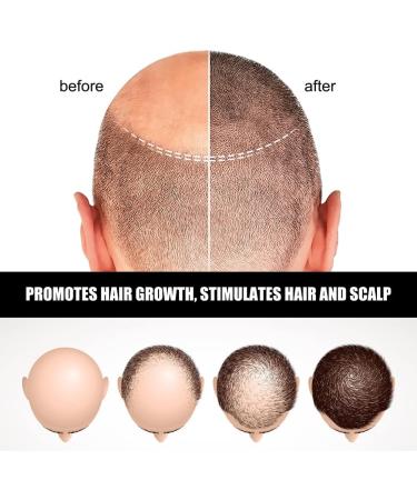 Katutude Hair Regrowth Essence Herbal Hair Growth Serum 40ML Natural Hair Regrowth Lotion Nourishing Serum for Women Men Prevent Hair Loss and Promote Stronger Longer Hair (5 Pack) - Buy Online on GoSupps.com