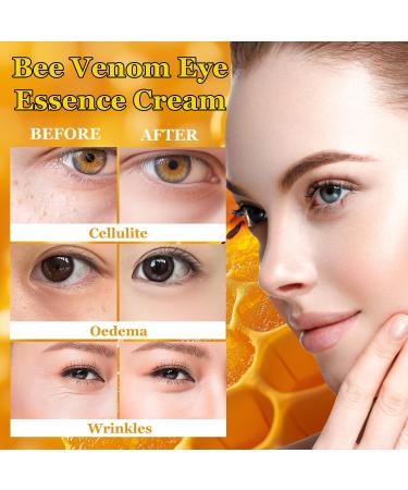  MagiSel Bee venom eye cream - For wrinkles and puffiness - For all skin types - 20 g - Buy Online on GoSupps.com