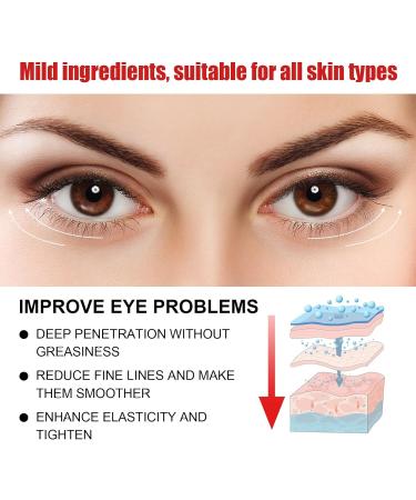 Retinol Eye Stick & Cream for Dark Circles | Anti-Aging Under Eye Balm | Moisturize & Firm Skin - Buy Online on GoSupps.com