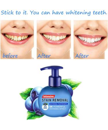Monshop Teeth Whitening Toothpaste - Effective Stain Removal for White Teeth & Bleaching - Blueberry Flavor - Buy Online on GoSupps.com