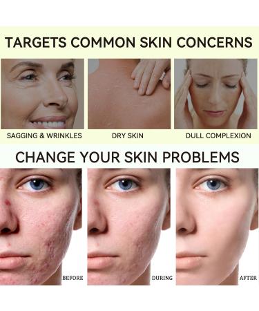 Weluno Beef Tallow for Skin Whipped Tallow and Honey Balm Grass Fed Beef Tallow Face Moisturizer Natural Tallow Skin Care Cream Body Butter Deeply Moisturizing for Face & Body 2.1 oz - Buy Online on GoSupps.com