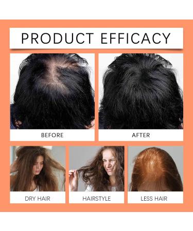 Natural Batana Oil for Healthy Hair Hair Butter with 100% Pure Raw Batana Oil Enhances Hair & Skin Radiance Hair Growth Butter for All Hair Types Promotes Hair Strength 4.23 oz - Buy Online on GoSupps.com