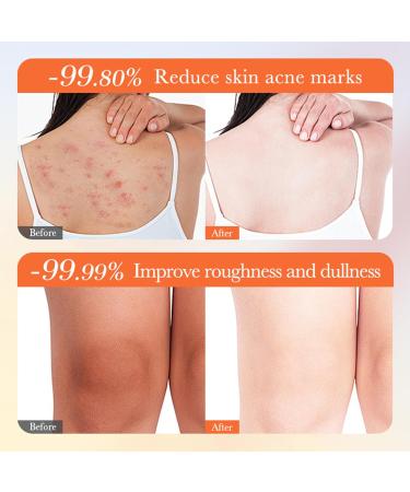 02 Skin So Soft Original Bath Oil 250 ml soft original bath oil for women with vitamin C moisturizing for dry and sensitive skin original skin bath oil so soft - Buy Online on GoSupps.com