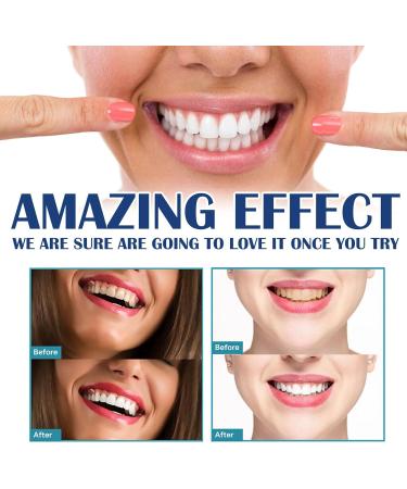 BODYA 5ml Teeth Whitening Gel Extra Strong White Tooth Whitener Tooth Paint for Adults - Buy Online on GoSupps.com