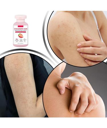  Fmzrbnih Strawberry Skin Lotion 100ml Body Scrub Strawberry Skin Cream For Legs - Softening Moisturizing Body Lotion For Chicken Neck Arm Legs Face Travel - Buy Online on GoSupps.com