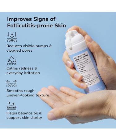 BellamiLuxx Folliculitis Acne Lotion for Body: Helps Reduce Itch Redness Body Acne Bumps & Uneven Texture with Salicylic & Glycolic Acid + Botanicals - Gentle Care for Folliculitis-Prone Skin - Buy Online on GoSupps.com