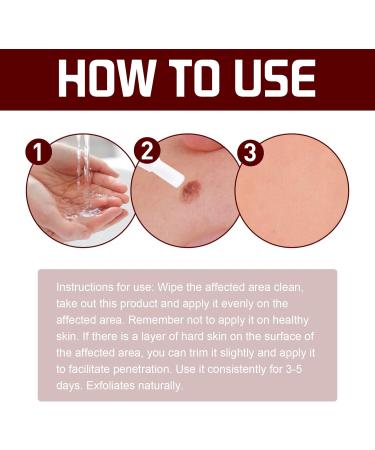 Wipe Off Moles & Skin Tags Remover Pen - Natural, Non-Irritating Formula for Easy Removal on Face & Body (2 PCS) - Buy Online on GoSupps.com